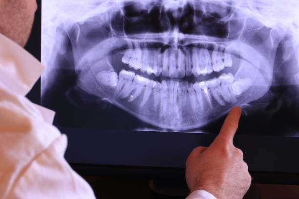Best Urgent Tooth Repair  in South Gate Ridge, FL