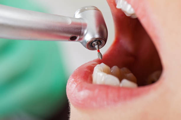 Best Tooth Infection Emergency Dentist  in South Gate Ridge, FL